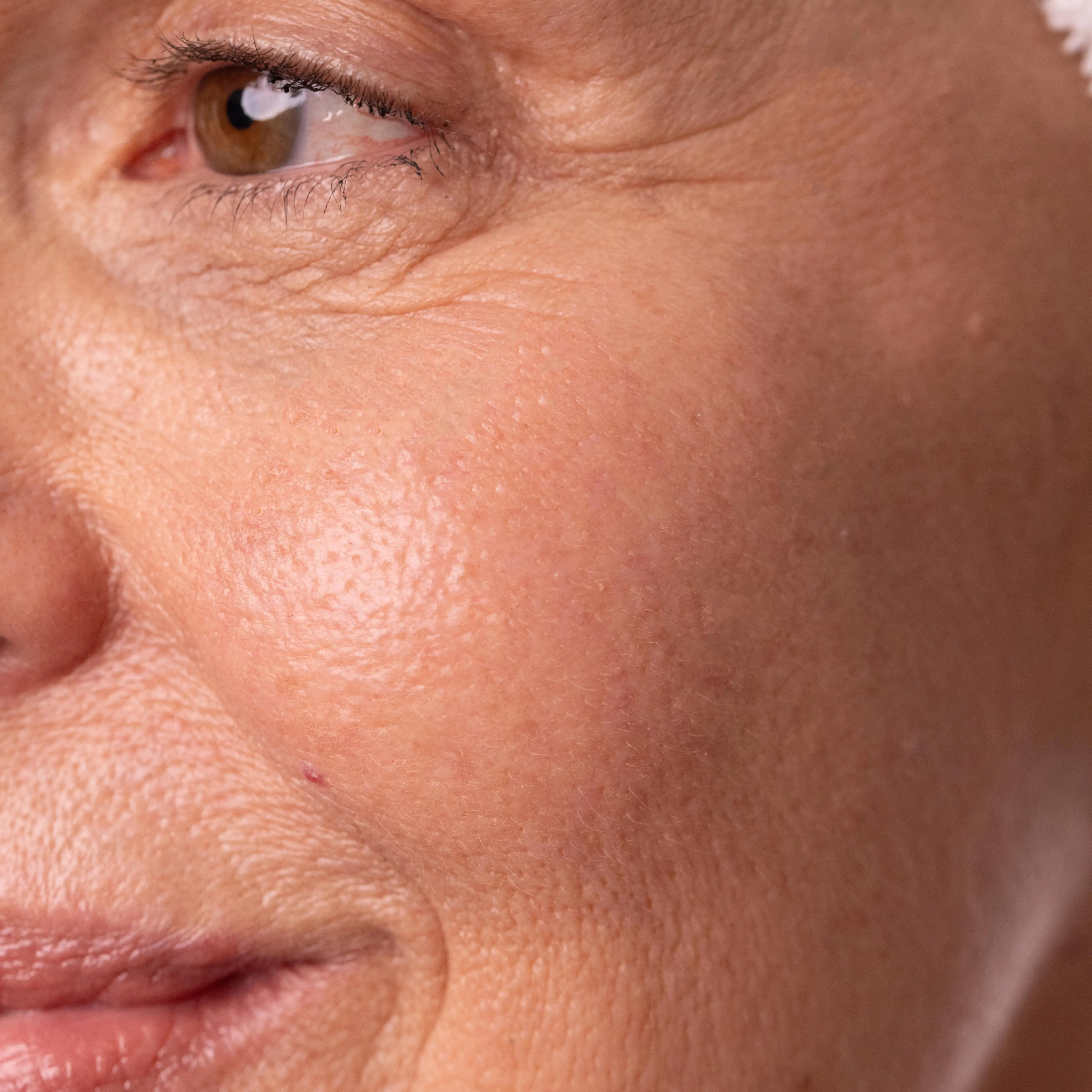 Intensive Mask Routine