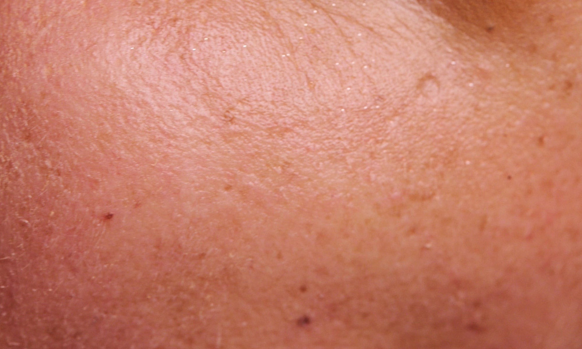 Haut unter dem Auge nach dem Einziehen von Viva Maia Shielding Sunscreen, ebenmäßig und ohne sichtbare Rückstände.
